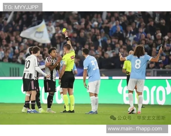 意媒报道布雷默米雷蒂国际比赛日后复出图多尔阵容恢复完整